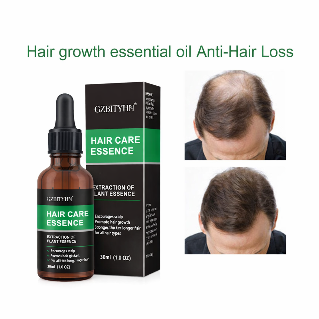 Hair Growth Oil Hair Growth Oil Oem Hair Care Essential Oil